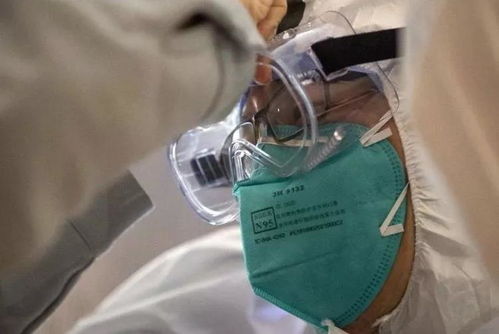 建言献策 新型冠状病毒肺炎的防治 来自麻醉科医生的建议