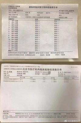 孔垂楠晒体检报告力证自己无性病,身心疲惫微博望网友停止辱骂