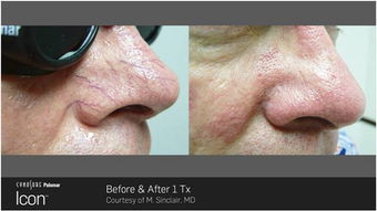 小悦体验 全中国仅14台的最先进仪器 一个平台,无限潜能 重回您的美丽巅峰