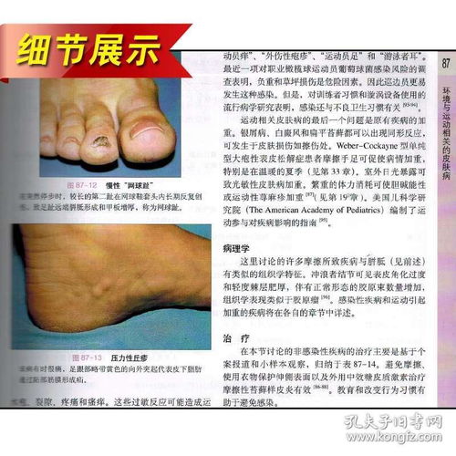 正版4册 皮肤病学教材版第2版第二版 皮肤科规范化培训教材 北京大学医学出版社中国临床皮肤病学 赵辨 性病学书籍 9787565912610