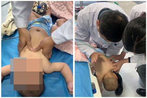 长治市中医医院成功救治一名1岁溺水幼儿