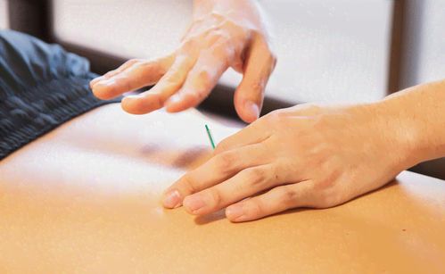 针灸治疗前能否服用药物 需遵医嘱并注意风险